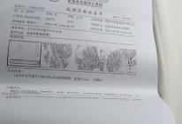 患者病例
